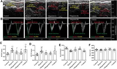 Magnolol Attenuates Right Ventricular Hypertrophy and Fibrosis in Hypoxia-Induced Pulmonary Arterial Hypertensive Rats Through Inhibition of the JAK2/STAT3 Signaling Pathway